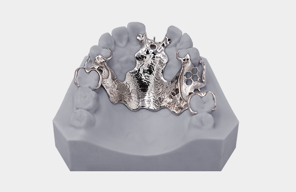 Metal 3D Printed Partial Denture Framework